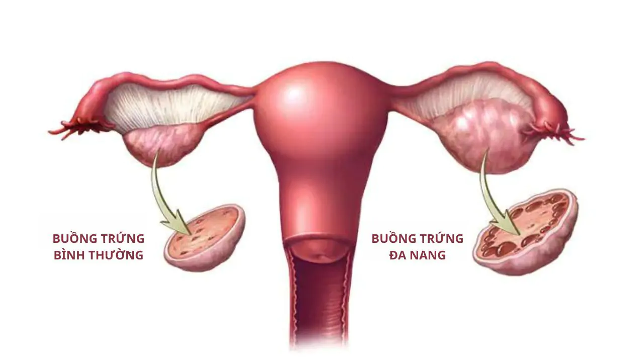 Dấu hiệu cảnh báo
